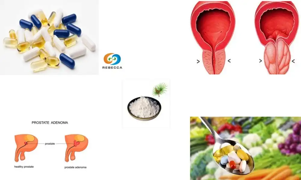 When Is the Best Time to Take Saw Palmetto Powder Supplement?